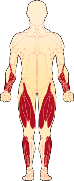 sIBM Atrophy